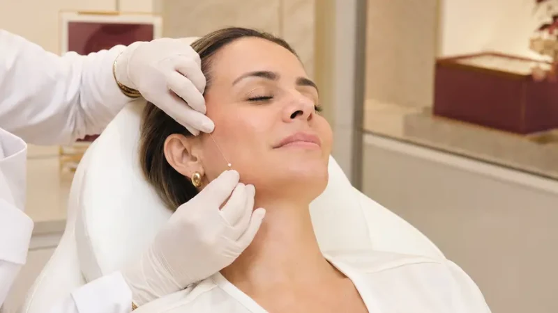 Aplicação de fios de sustentação facial na VRM, em Santo André