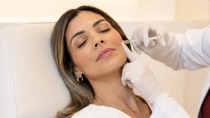 Preenchimento facial com ácido hialurônico realizado por biomédica esteta em Santo André